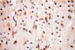 MYO1A Antibody in Immunohistochemistry (Paraffin) (IHC (P))