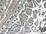 MYO1A Antibody in Immunohistochemistry (Paraffin) (IHC (P))