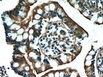 MYO1A Antibody in Immunohistochemistry (Paraffin) (IHC (P))