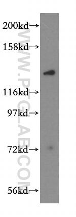 MYO1A Antibody in Western Blot (WB)