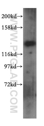 MYO1A Antibody in Western Blot (WB)