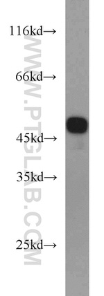 EIF4A3 Antibody in Western Blot (WB)