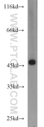 EIF4A3 Antibody in Western Blot (WB)