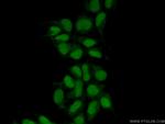 MAK16 Antibody in Immunocytochemistry (ICC/IF)