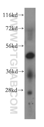 MAK16 Antibody in Western Blot (WB)