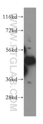 MAK16 Antibody in Western Blot (WB)