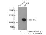 RAI14 Antibody in Immunoprecipitation (IP)