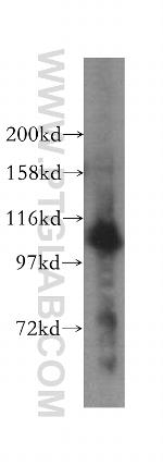 RAI14 Antibody in Western Blot (WB)