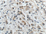 IRS1 Antibody in Immunohistochemistry (Paraffin) (IHC (P))