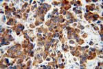 IRS1 Antibody in Immunohistochemistry (Paraffin) (IHC (P))