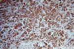 IRS1 Antibody in Immunohistochemistry (Paraffin) (IHC (P))