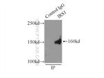 IRS1 Antibody in Immunoprecipitation (IP)