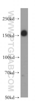 IRS1 Antibody in Western Blot (WB)