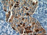 Somatostatin Antibody in Immunohistochemistry (Paraffin) (IHC (P))