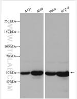 Cytokeratin 8 Antibody in Western Blot (WB)