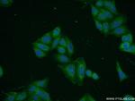 Cytokeratin 8 Antibody in Immunocytochemistry (ICC/IF)