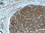 Cytokeratin 8 Antibody in Immunohistochemistry (Paraffin) (IHC (P))