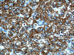 Cytokeratin 8 Antibody in Immunohistochemistry (Paraffin) (IHC (P))