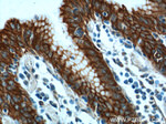 Cytokeratin 8 Antibody in Immunohistochemistry (Paraffin) (IHC (P))