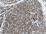 Cytokeratin 8 Antibody in Immunohistochemistry (Paraffin) (IHC (P))