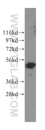 Cytokeratin 8 Antibody in Western Blot (WB)