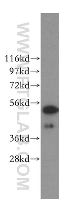 Cytokeratin 8 Antibody in Western Blot (WB)