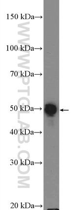 Cytokeratin 8 Antibody in Western Blot (WB)