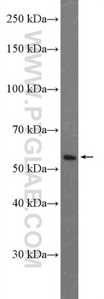 Cytokeratin 8 Antibody in Western Blot (WB)