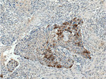 Cytokeratin 17 Antibody in Immunohistochemistry (Paraffin) (IHC (P))