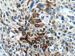 Cytokeratin 17 Antibody in Immunohistochemistry (Paraffin) (IHC (P))