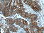 Cytokeratin 17 Antibody in Immunohistochemistry (Paraffin) (IHC (P))