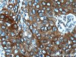 Cytokeratin 17 Antibody in Immunohistochemistry (Paraffin) (IHC (P))