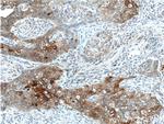 Cytokeratin 17 Antibody in Immunohistochemistry (Paraffin) (IHC (P))