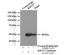 Cytokeratin 17 Antibody in Immunoprecipitation (IP)