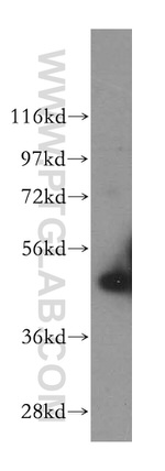 Cytokeratin 17 Antibody in Western Blot (WB)