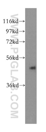 Cytokeratin 17 Antibody in Western Blot (WB)