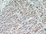 ACTA1 Antibody in Immunohistochemistry (Paraffin) (IHC (P))