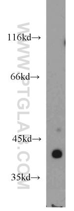 ACTA1 Antibody in Western Blot (WB)