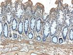 ACADL Antibody in Immunohistochemistry (Paraffin) (IHC (P))