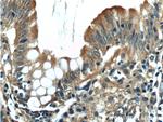 ACADL Antibody in Immunohistochemistry (Paraffin) (IHC (P))