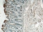 ACADL Antibody in Immunohistochemistry (Paraffin) (IHC (P))