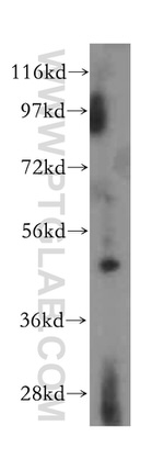 ACADL Antibody in Western Blot (WB)