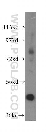 ACADL Antibody in Western Blot (WB)