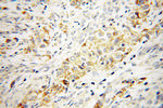 CTDSPL2 Antibody in Immunohistochemistry (Paraffin) (IHC (P))