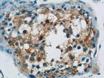 CTDSPL2 Antibody in Immunohistochemistry (Paraffin) (IHC (P))