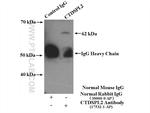 CTDSPL2 Antibody in Immunoprecipitation (IP)