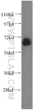 CTDSPL2 Antibody in Western Blot (WB)