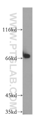 CTDSPL2 Antibody in Western Blot (WB)