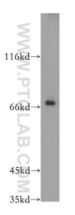 CTDSPL2 Antibody in Western Blot (WB)