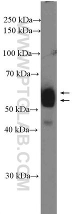 EARS2 Antibody in Western Blot (WB)